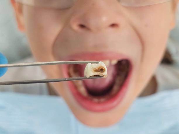 Best Pediatric Emergency Dentist in Holtville, AL